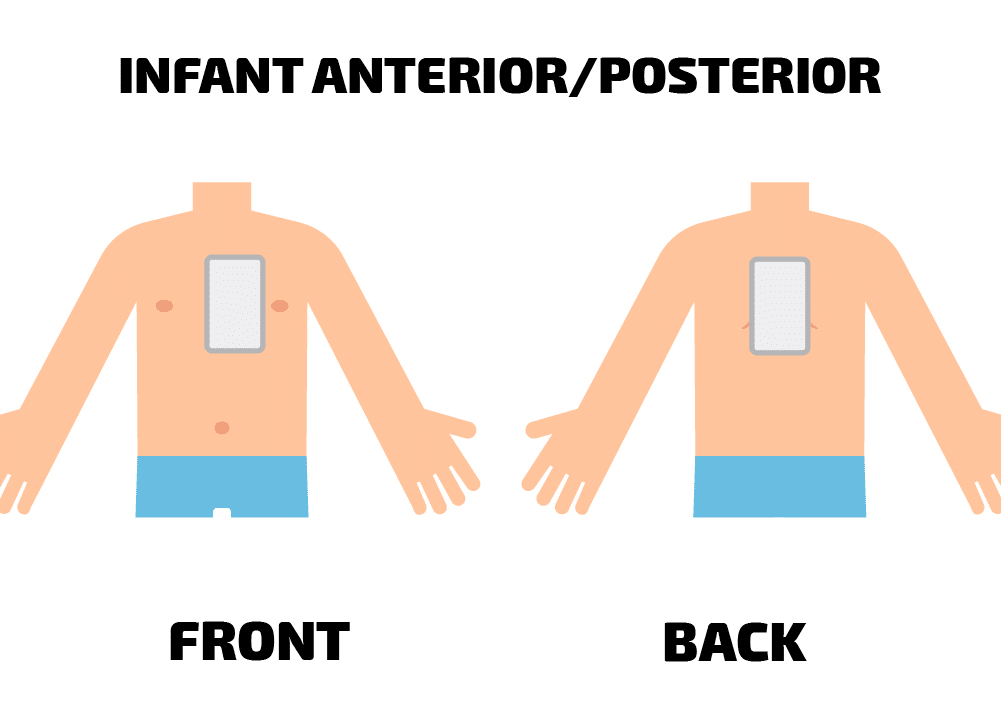 front back infant pad placement